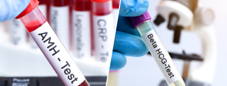 AMH & β-hCG là gì? Giải mã 02 chỉ số quan trọng trong hành trình hỗ trợ sinh sản
