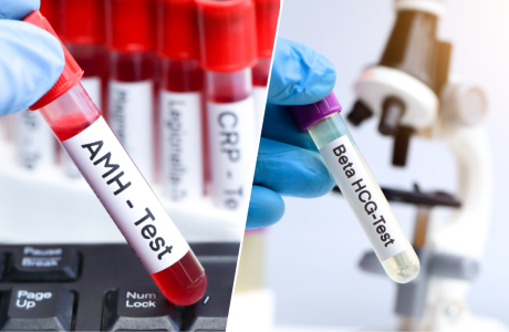 AMH & β-hCG là gì? Giải mã 02 chỉ số quan trọng trong hành trình hỗ trợ sinh sản